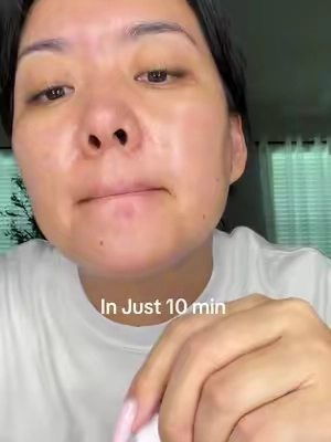 #acneskin #pimples #blemishes #dralthea #tiktokshopsummersale @Dr.Althea Global is my absolute fav skincare brand 