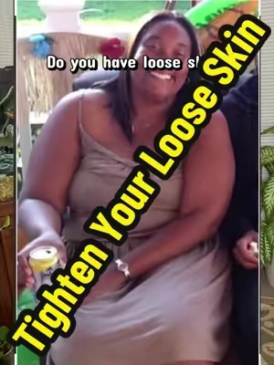 Tighten your loose skin #teelatok #armskinremoval #armlift #armsleeve #armbands  