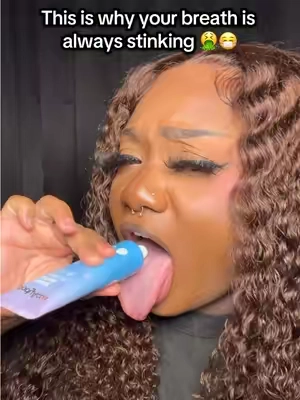 👅 Clean that tongue babe !!! #bodyaccel #oralcareroutine #glowupessentials #dealsforyoudays #teethwhitening 