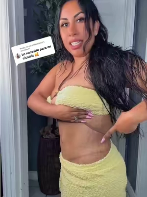 Replying to @elcambiodeluz west more beauty body coverage! Body makeup! Cover scars, stretch marks, cellulitis, hyperpigmentation. Plastic surgery scars @Westmore Beauty #beauty #bodymakeup #plasticsurgery #scars #tiktokshopcreatorpicks 