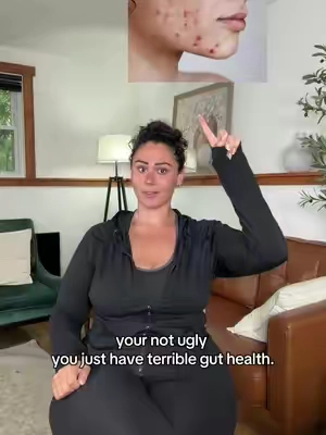 FIX. YOUR. GUT.  #guthealth #goligummies #golisuperbrandday @Goli® Nutrition 