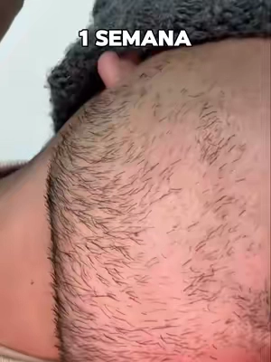 Mi barba se está volviendo cada vez más espesa. Funciona de maravilla.🧔🧔🫡#beardgrowth #beardcare #beards #beardmen #beardserum 