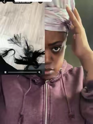 #fyp #hairgrowth #viral 