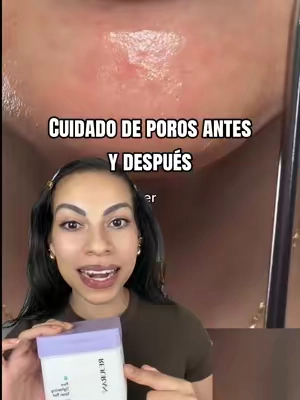 Mejorar los poros y la textura de la piel es un proceso que toma tiempo pero los resultados valen toda la pena 🫶🏻💕✨ #pores #texturedskin #tonerpad #rejuran #porecare @REJURAN US 