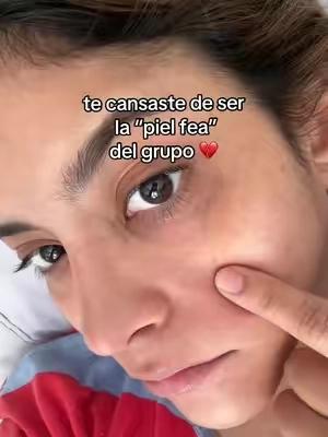me quite un peso muy grande de encima ❤️ #GlowUp #pielbonita #skincare #cuidadodelapiel 