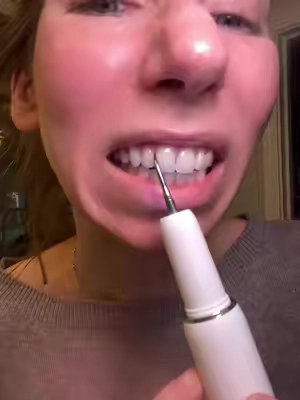 At home touch ups #plaqueremover #CleanTok #oralhealth #electricplaqueremover #athomebeauty 