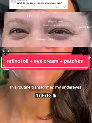If you have under eye wrinkles, crepey under eyes, eye bags, or dark circles, this under eye routine is worth trying. I combine retinol, a hydrating eye cream, and eye patches to target fine lines while keeping my under eyes looking smoother, brighter, and more hydrated. No single product transformed my under eyes. Consistency with the right routine did. #UnderEyeWrinkles #EyeBags #DarkCircles #Retinol #EyePatches @COSRX US @Then I Met You @DR MELAXIN SKIN 