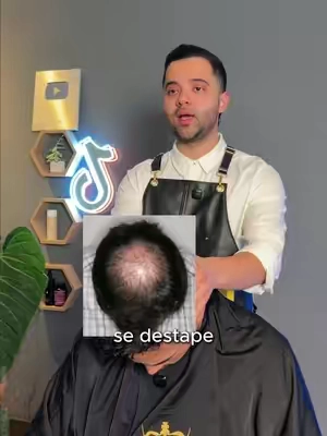 Yo usaba cualquier champú del supermercado hasta que vi cómo otros tipos estaban presumiendo su pelo, bro. 🔥💪 #haircare #hairhealth #thickhair #menskincare #hairtips Disclaimer: results may vary 