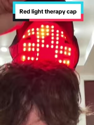 Receiving hairline and hair shedding no more #tiktokshopcreatorpicks #balding #hairloss #hairlosssolutions #redlighttherapy 
