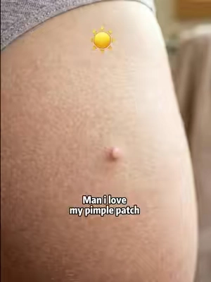 #fyp #tktkpimplepatch #pimplepoping #pimple #pimplepatch 