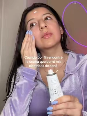 Mi piel volvio a ser la de antes!! #skincare #acnescars #GlowUp #dralthea345cream #cicatricesdeacne 