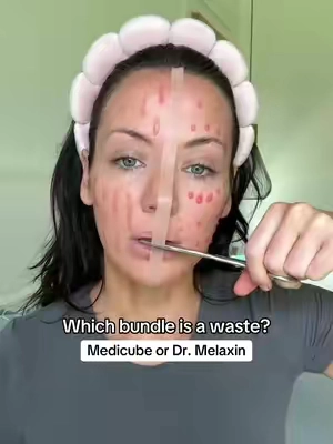 Both are elite in potency but I have to credit my skin glowup to my OG  Dr. Melaxin, I’ve used it for over 365 sleeps lol and it will always be the standard on my 40 yr facecard. 