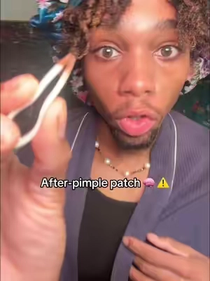 This is so important especially if you’re prone to dark spots 