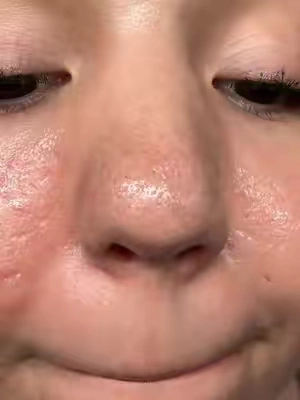 I tried this viral face mask on a potato and on my own face 👀 I thought it was a scam… until I saw my own nose 😳 #skincare #blackhead #glassskin #drleohonestreview #fyp 