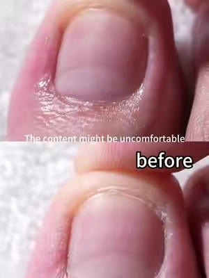 Say bye-bye to my ugly toes!#qiek #cuticleoil #nails #TikTokshopbacktoschool#cuticleprep