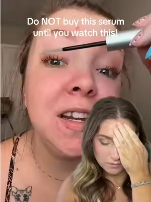 #greenscreenvideo why are we still buying the single serum when they make a bundle with the black serum in it!!! Run.  #lashserum #lash #lashgrowth 