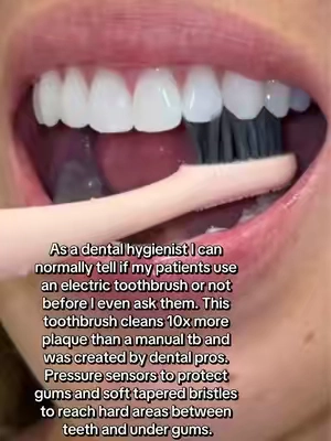 If you’re still brushing with a manual toothbrush, this is your sign to upgrade. An electric toothbrush cleans up to 10x more effectively than a manual toothbrush when used properly, making it easier to remove plaque and support healthier gums. And this isn’t just about having a prettier smile, your oral health is connected to your overall health. Poor oral health and gum disease have been associated with conditions including cardiovascular disease and stroke, and also found links between gum disease and dementia. Your mouth is part of your body, so taking care of it matters. If an electric toothbrush makes it easier for you to consistently remove plaque and care for your gums, it’s a simple upgrade that can make a big difference.  #electrictoothbrush #toothbrush #teethcare #whiterteeth #whitesmile 