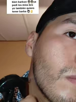 #paratiiiiiiiiiiiiiiiiiiiiiiiiiiiiiii #barbon #minoxidil 