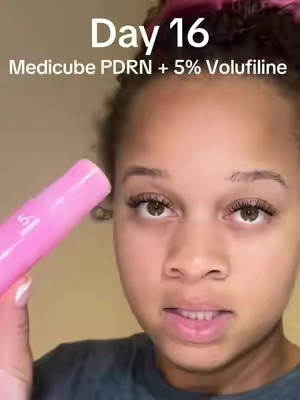 Day 16 of using Medicube PDRN & 5% Volufiline under my eyes to fill in the hollows and on my face to plump it up. Ignore my hair 🤦🏽‍♀️ I’ll be back tomorrow for day 17! #medicube #pdrn #filler #collagen #skincare