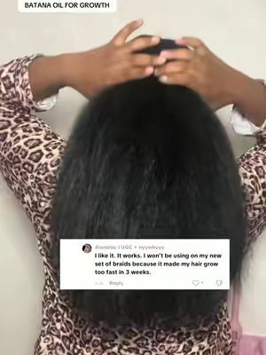 #fyp #hairgrowth #viral 