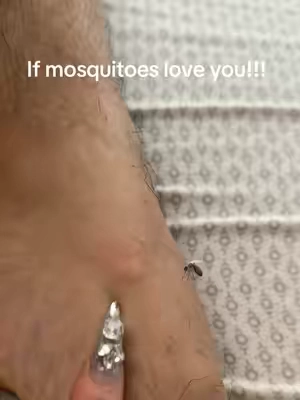 Best hack to get rid of that itch @Bug Bite Thing #bugbitething #mosquito #bugbite #itchy #mosquitohack 