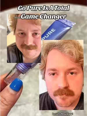 This Product Has Been A Complete Game Changer for my son!!! Go Pure Instant Lift Eye Gel is amazing! It took away my sons undereye bags and swollen eyes! @Gopure  #undereyebags #eyebags #swolleneyes #gopure #darkeyecircles 