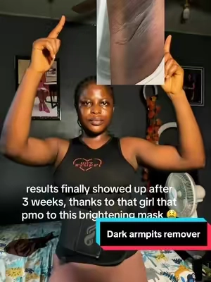 All it takes is 3times daily use and a whole 3 weeks of consistency!! #darkarmpits #darkunderarms #unevenskintone #brighteningmask #koreanskincare 