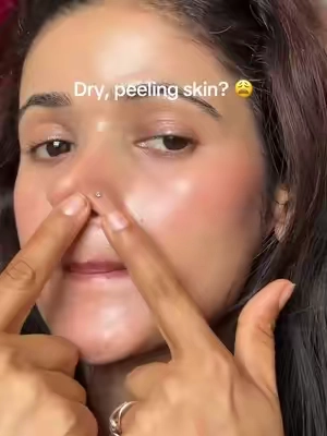 Skin dry & peeling ko problem xa vane try this 👆🫰#tiktokshop #foryou #tiktok #dalbasprayserum 