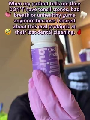 Best feeling as a dental hygienist.🥹This is why I do what I do. Yes, I love seeing cleaner teeth and healthier gums, but knowing that something I taught my patient actually made a difference in their everyday life? That’s the part that gets me every time. I don’t just want to clean your teeth every six months. I want to give you the tools and education to feel confident taking care of your mouth every single day. 🫶🏼 #tonsilstones #freshbreath #healthygums #teethcare #oralprobiotics 