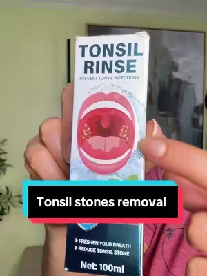 #tonsilstonesremoval #TikTokshopbacktoschool #enjuaguebucal #malaliento 