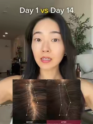 USE CODE “INERCLARA” for ADDITIONAL 10% OFF (until end of August)‼️ Just landed here from Korea— hair loss shampoo developed by korean women scientists ✨ @INERTIA US #INERTIA #ForteShampoo #SpiderSilkProtein #ScalpRepair #HairLossTips