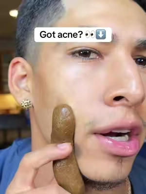 Glow up your skin with these #skintific #claystick #skincareroutine #oilcontrol #clearskin 