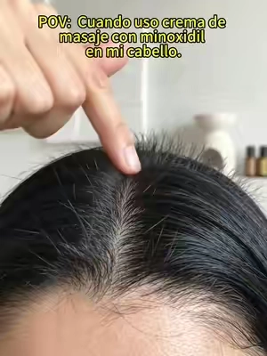 De verdad me arrepiento de no haberlo usado antes. Ahora estoy muy feliz con cómo se ve mi cabello. ¡Te recomiendo que tú también lo pruebes! Y lo mejor es que ahora mismo hay una súper oferta 🔥✨#HairCareTips #Minoxidil#SummerWins #DealsForYouDays