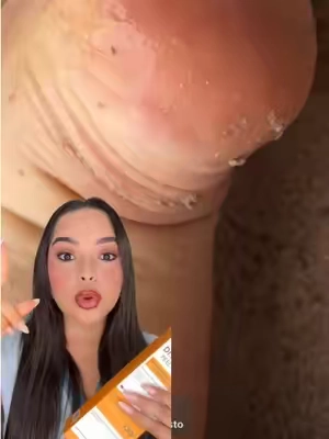 Link directo aquí arriba de mi nombre ⬆️⬆️ Este es un Peel Shot que te hace una exfoliación suave, eliminando células muertas de la piel  . . . . . #drmelaxin #drmelaxinpeelshot #mabellrodrigueztiktokshop #talonesagrietados #nr 