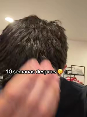 Me salvo el cabello