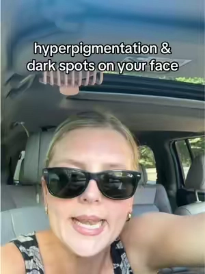 Replying to @erin when you have hyperpigmentation and dont wanna mess around.  this is my experience, it’s not medical advice and results may vary 