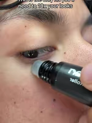just upgrade your eye area bro.
