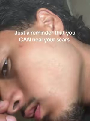 7673196036449389837
