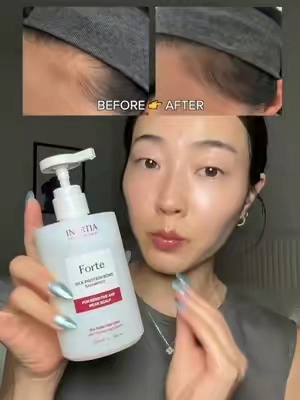 USE CODE “INERCLARA” for ADDITIONAL 10% OFF (until end of August)‼️ developed for women, by women 💇🏻‍♀️ try this spider silk protein hair loss shampoo that's designed to actually address the root cause— your scalp! #INERTIA #ForteShampoo #SpiderSilkProtein #ScalpRepair #HairLossTips @INERTIA US 