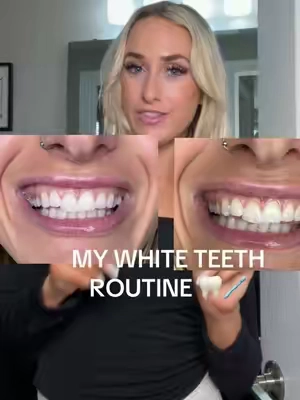 Pearly whites on a budget 😃#teethwhitening #teethwhiteningstrips #whiteteeth #teethcare @Lumineux 