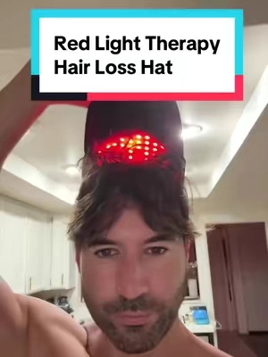Receiving hairline and hair shedding no more #tiktokshopcreatorpicks #balding #hairloss #hairlosssolutions #redlighttherapy 