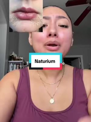 Azelaic serum for sensitive irritated skin #azelaicacid #skincareforsensitiveskin #naturium @Naturium 