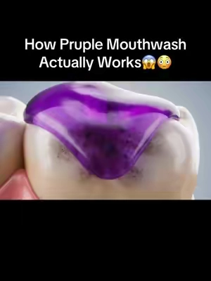 I did NOT expect that😳