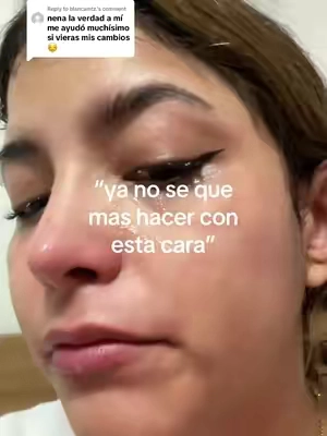 Replying to @blancamtz. la piel asi de bonita te devuelve toda la confianza nena #pielbonita #antimanchas #antiarrugas #GlowUp #pielporcelana 