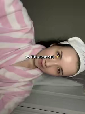 wish i stopped listening to trends #acnetreatment #acne #tiktokshopsale #tiktokshop 