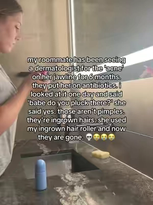 GIRL GENIUSSSS  #ingrownhair #shavingbumps #ingrownhairs #bfrelatable #couplegoals      
