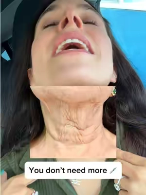 Not neckgina 😭 #TikTokshopbacktoschool #tiktokshopblackfriday #ad #antiagingskincare #neckcare @DermDoctor | Dr. Shah @Remedy Science individual results may vary