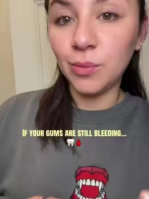 If your gums are still bleeding in 2026 it’s time to get a water flosser #dentalhygienist #periodontaldisease #gingivitis #oralhealth #dentalroutine 
