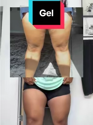 #sarahskinprogress she’s worth the hype. #resultsmayvary 