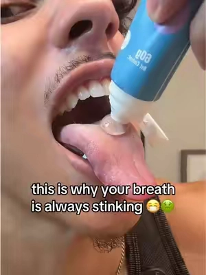 my tongue is THANKING me (and my girlfriend too) #badbreath #freshbreath #TongueCleaning #tonguescraper #bodyaccel 